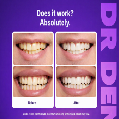 Purely Glow Purple Teeth Whitening Strips